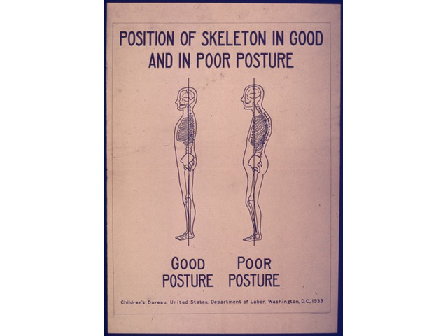 Back Posture Corrector